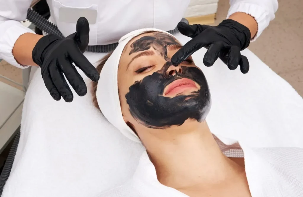 Laser Carbon Peel