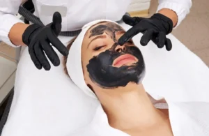Laser Carbon Peel