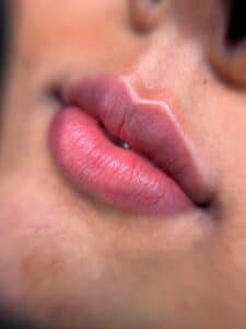 Lip Neutralization