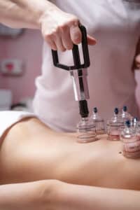 Cupping & Recovery