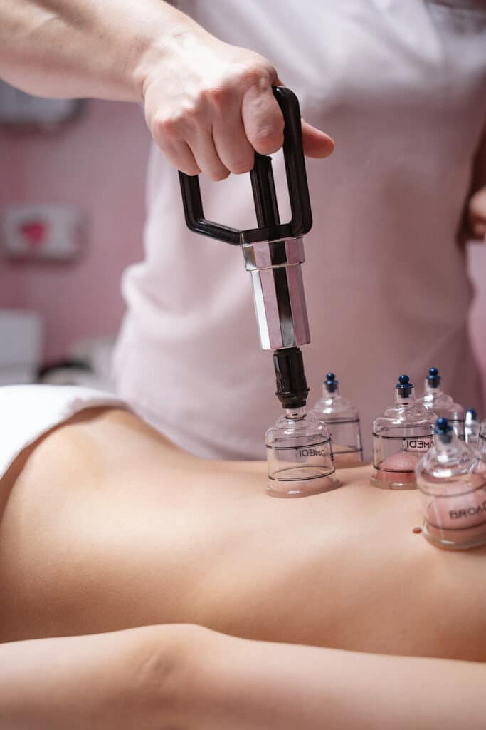 Cupping & Recovery